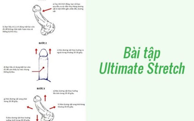 khắc phục dương vật bị cong