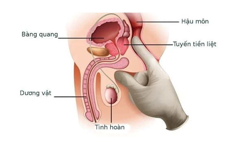 điểm G